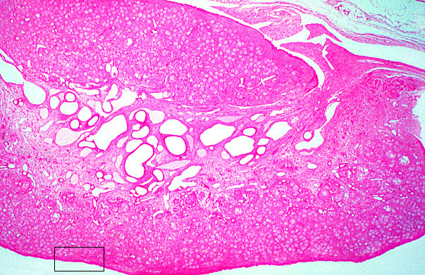 Hls Female Reproductive System Ovary Cortex Med Mag L Vrogue Co