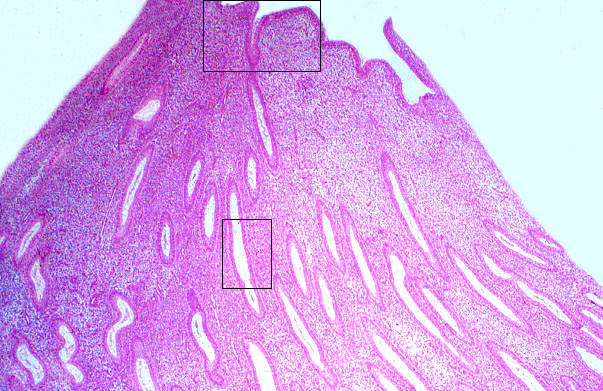  uterus, endometrium 