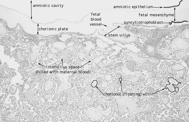  placenta, fetal side 