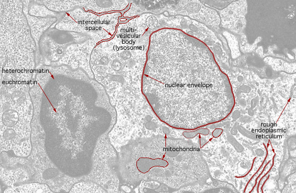  nuclear morphologies, nuclei and cytoplasm 