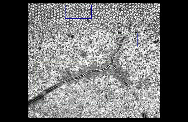 HLS [ Ultrastructure of the Cell, microvillous border and Junctional ...