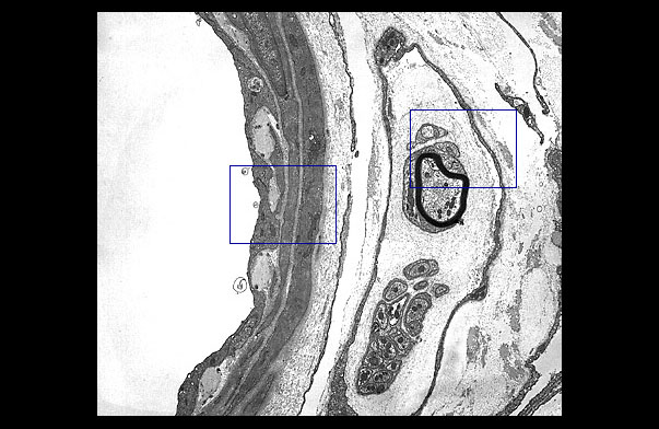  arteriole and peripheral nerve 