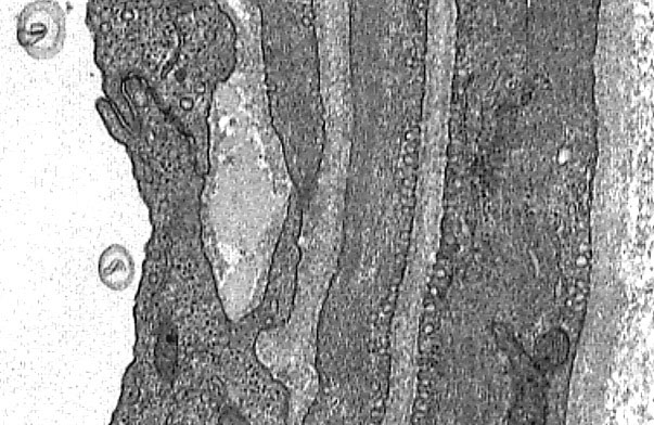  arteriole and peripheral nerve, endothelium and smooth muscle 