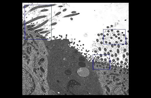  ciliated epithelium 