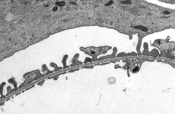  podocytes and glomerular capillaries, endothelium and podocyte 