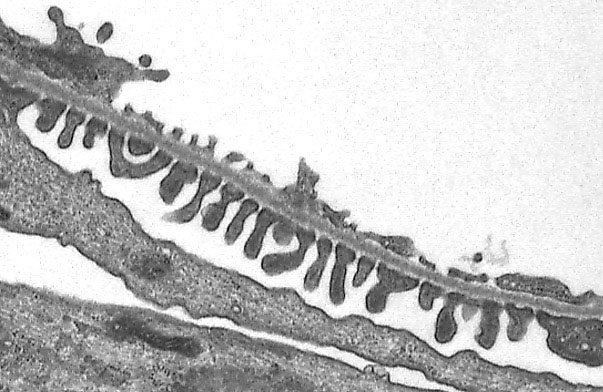  podocytes and glomerular capillaries, filtration barrier 