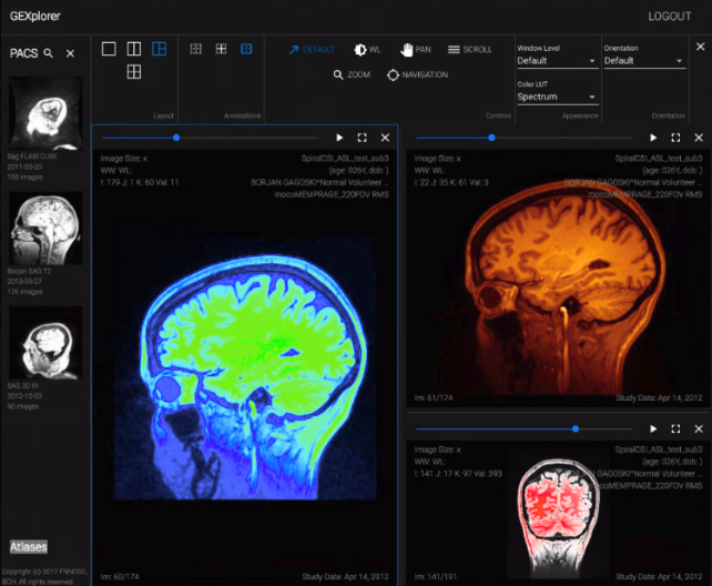 Screenshot of a radiology image viewer, with sample MRI images from different angles displayed