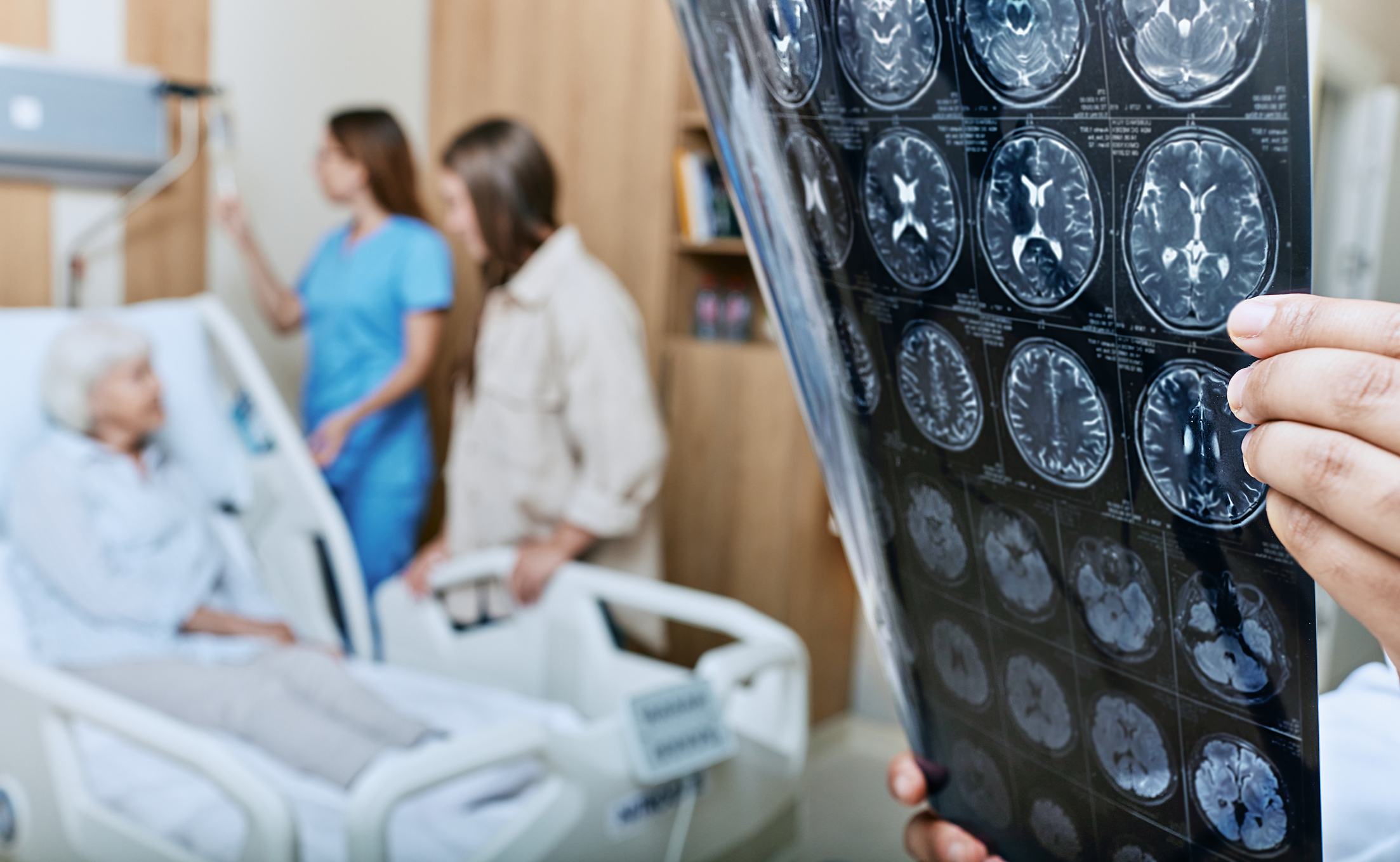 MRI of head of elderly woman in hands of doctor standing in medical ward near senior patient with relative and nurse. Recovery after a stroke